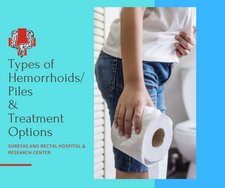 Types of Hemorrhoids - Piles & Treatment options - Proctocure