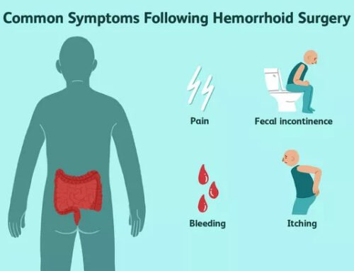 What are the possible complications of hemorrhoid surgery?